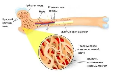 Трабекулярной набряк кісткового мозку що це таке, і як лікувати (трабекулярной набряк кісткового) Трабекулярной набряк кісткового мозку що це таке, і як лікувати