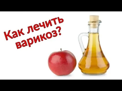 Трави при варикозі які пити для лікування варикозного розширення вен (варикоз) Трави при варикозі які пити для лікування варикозного розширення вен