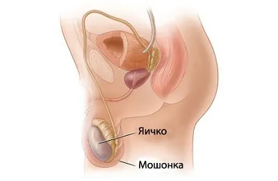 Варикоцеле у підлітків лікування без операції і причини виникнення варикозу яєчка в 14-16 років (операції) Варикоцеле у підлітків лікування без операції і причини виникнення варикозу яєчка в 14-16 років