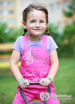 Вітрянка у дітей лікування (лікування вітрянки у дітей препарати) Вітрянка у дітей лікування