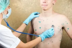 Вітряна віспа з чим можна переплутати, як лікувати (переплутати) Вітряна віспа з чим можна переплутати, як лікувати