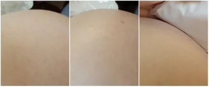 Вітер змін або як підготуватися до змін фігури і допомогти шкірі не розтягнутися бонус від (змін) Вітер змін або як підготуватися до змін фігури і допомогти шкірі не розтягнутися бонус від