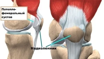 Вивих надколінка симптоми, лікування, операція (надколінка) Вивих надколінка симптоми, лікування, операція