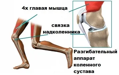 Вивих надколінка симптоми, лікування, операція (вивих) Вивих надколінка симптоми, лікування, операція