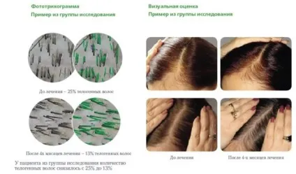 Вітаміни для волосся Пантовігар відгуки, правила прийому (волосся) Вітаміни для волосся Пантовігар відгуки, правила прийому
