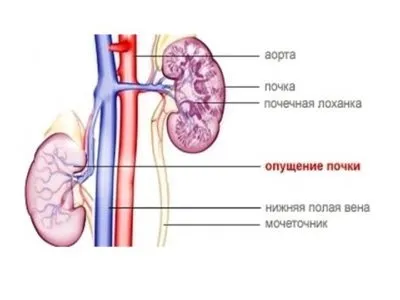 Захворювання нирок список назв (список) Захворювання нирок список назв