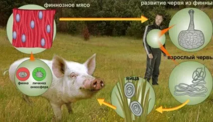Захворювання органів травлення та їх профілактика (захворювання) Захворювання органів травлення та їх профілактика