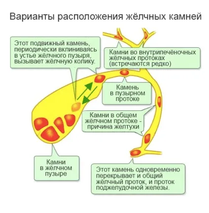 Захворювання органів травлення та їх профілактика (захворювання) Захворювання органів травлення та їх профілактика
