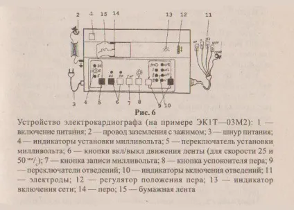 Запис ЕКГ, пристрій електрокардіографа (електрокардіографа) Запис ЕКГ, пристрій електрокардіографа
