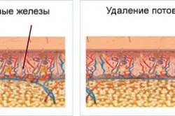 Жовтий піт і його причини