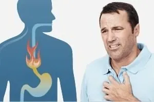 Печіння в стравоході, горлі при прийомі їжі причини (печіння) Печіння в стравоході, горлі при прийомі їжі причини