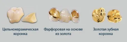 зубне золото
