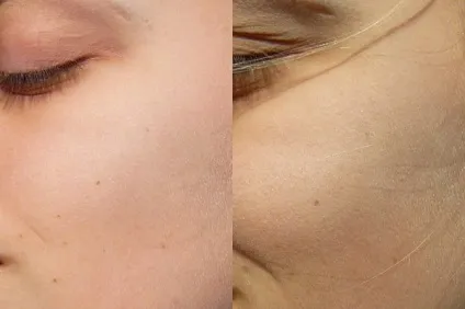 Chanel irreelle blush fard a joues douceur silky cheek colour # 90 snow відгуки (chanel) Chanel irreelle blush fard a joues douceur silky cheek colour # 90 snow відгуки