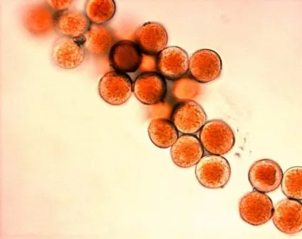 Бура іржа пшениці (іржа пшениці Puccinia) Бура іржа пшениці