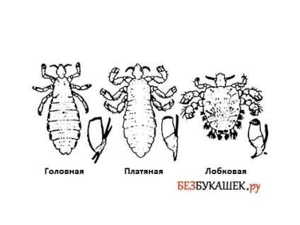 Чого бояться воші бояться запаху, спеки, холоду (бояться воша запах спека холод) Чого бояться воші бояться запаху, спеки, холоду