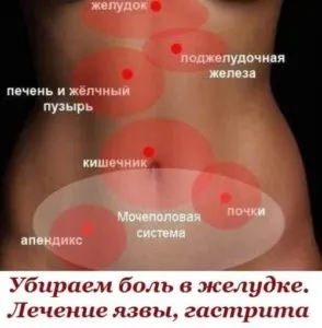 Чим зняти біль в шлунку при гастриті найкраще (гастриті) Чим зняти біль в шлунку при гастриті найкраще