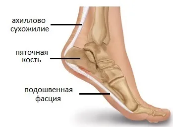 Що робити якщо болить сухожилля над п'ятою, травми і лікування (травми) Що робити якщо болить сухожилля над п'ятою, травми і лікування