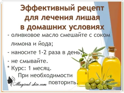 Чистотіл від позбавляючи у людини лікування, відгуки (чистотіл лишай лікування осіб проти відгук) Чистотіл від позбавляючи у людини лікування, відгуки