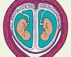 А ви знаєте від чого залежить народження двійні, мітки ймовірність, близнюк (двійні?) А ви знаєте від чого залежить народження двійні, мітки ймовірність, близнюк