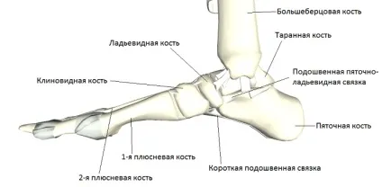 Асептичний некроз таранної кістки лікування (некроз таранної кістки) Асептичний некроз таранної кістки лікування