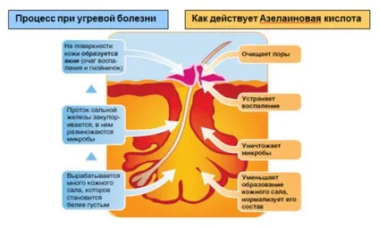 Азелаиновая кислота в косметології дію і застосування (азелаїнова кислота косметологія дію застосування) Азелаиновая кислота в косметології дію і застосування
