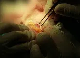 Блефаропластика нижніх і верхніх повік ціни, відгуки, клініка, інтернет-журнал (верхніх) Блефаропластика нижніх і верхніх повік ціни, відгуки, клініка, інтернет-журнал