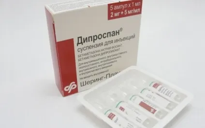 Блокада п'яткової шпори Дипроспаном - методика і вартість (шпори) Блокада п'яткової шпори Дипроспаном - методика і вартість