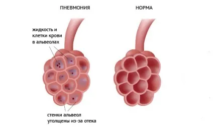 Частий кашель у дитини що можна зробити і як йому допомогти (можна) Частий кашель у дитини що можна зробити і як йому допомогти