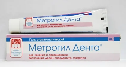 Що краще використовувати для лікування ясен, метрогил дента або холісал