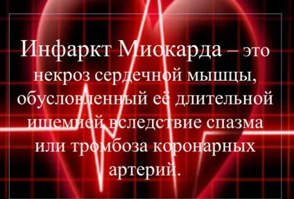Інфаркт - що це таке, міокарда, головного мозку, чи можна пити каву, водити машину,