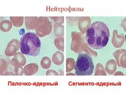 Клітини крові людини під мікроскопом як вони називаються і що роблять (мікроскопом) Клітини крові людини під мікроскопом як вони називаються і що роблять