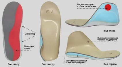 Кісточка на нозі причини появи, методи лікування, профілактика (причини) Кісточка на нозі причини появи, методи лікування, профілактика