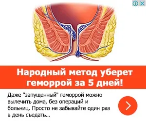 Лікування геморою народними засобами швидко