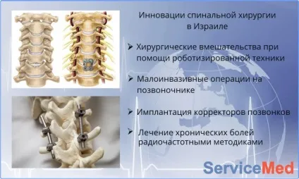 Лікування сколіозу в Ізраїлі ціни та відгуки, знайомства (лікування сколіозу в Ізраїлі) Лікування сколіозу в Ізраїлі ціни та відгуки, знайомства