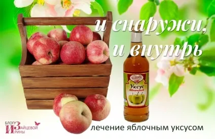Лікування гіпертонії яблучним оцтом болить голова і підвищений тиск причини і лікування (при гіпертонії заняття спортом) Лікування гіпертонії яблучним оцтом болить голова і підвищений тиск причини і лікування