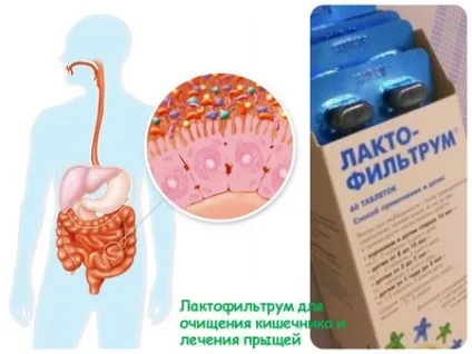 Лактофільтрум від прищів показання, застосування, відгуки (зростання патогенних мікробів) Лактофільтрум від прищів показання, застосування, відгуки