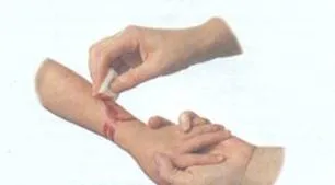 Лимфангит симптоми і лікування