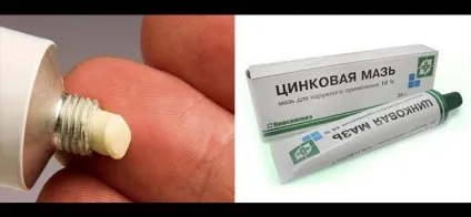 Мазь від позбавляючи у людини ефективні засоби