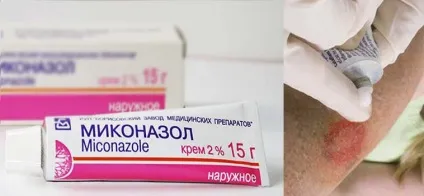 Мазь від позбавляючи у людини ефективні засоби