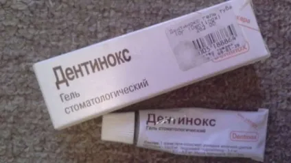 Чи можна лікувати і видаляти зуби при застуді і ГРВІ (можна) Чи можна лікувати і видаляти зуби при застуді і ГРВІ