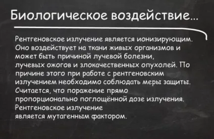 Чи можна робити рентген зуба при вагітності дізнайтеся з нашої статті! (Вагітності) Чи можна робити рентген зуба при вагітності дізнайтеся з нашої статті!