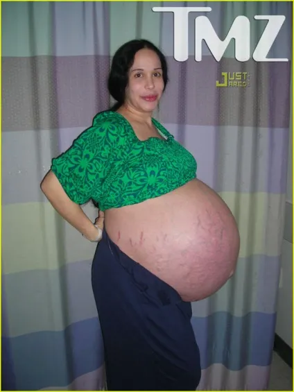 Наді Суліман багатодітна мама) надя Сулейман як зараз живе, мітки Октомама, Сулеман, самий, (вагітність по тижнях) Наді Суліман багатодітна мама) надя Сулейман як зараз живе, мітки Октомама, Сулеман, самий,