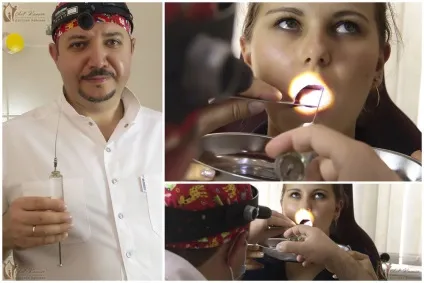 Як і чим можна промити гланди в домашніх умовах (домашніх) Як і чим можна промити гланди в домашніх умовах