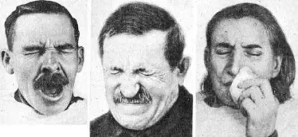 Невралгія трійчастого нерва симптоми, ознаки, ускладнення (симптоми невралгії трійчастого нерва) Невралгія трійчастого нерва симптоми, ознаки, ускладнення