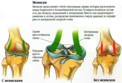 Нестабільність колінного суглоба (нестабільність) Нестабільність колінного суглоба