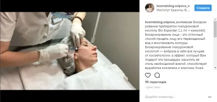 Особливості проведення биоревитализации (необхідна консультація фахівця) Особливості проведення биоревитализации