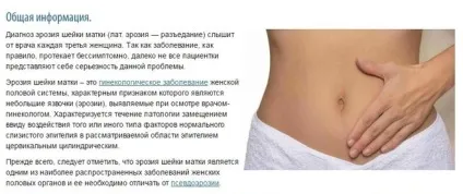 Чи передається ерозія шийки матки статевим шляхом (см) (ерозія) Чи передається ерозія шийки матки статевим шляхом (см)