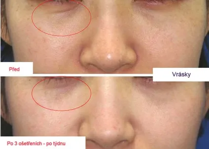 Пептидная мезотерапія dermaheal meso знайомимося з препаратами лінії (meso) Пептидная мезотерапія dermaheal meso знайомимося з препаратами лінії