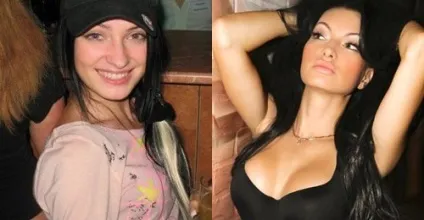 Пластичні операції евгении Феофілактова зірка до і після пластики (пластичні) Пластичні операції евгении Феофілактова зірка до і після пластики