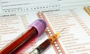 Показники алт і аст у чоловіків норма і відхилення, підготовка і здача аналізу, співвідношення (всіх тканинах організму) Показники алт і аст у чоловіків норма і відхилення, підготовка і здача аналізу, співвідношення
